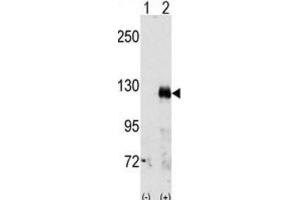 Western Blotting (WB) image for anti-EPH Receptor A3 (EPHA3) antibody (ABIN3003329) (EPH Receptor A3 anticorps)