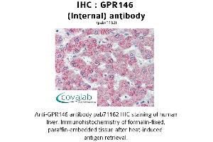 Image no. 1 for anti-G Protein-Coupled Receptor 146 (GPR146) (Internal Region) antibody (ABIN1734950) (GPR146 anticorps  (Internal Region))