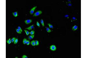 Immunofluorescent analysis of HepG2 cells using ABIN7170243 at dilution of 1:100 and Alexa Fluor 488-congugated AffiniPure Goat Anti-Rabbit IgG(H+L)