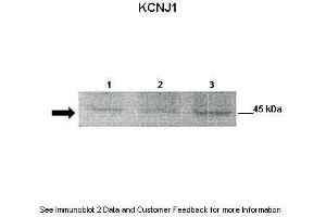 Lanes:   Lane 1: 30ug mouse renal epithelial lysate Lane 2: 30ug mouse renal epithelial lysate Lane 3: 30ug mouse renal epithelial lysate  Primary Antibody Dilution:   1:500  Secondary Antibody:   Anti-rabbit-HRP  Secondary Antibody Dilution:   1:2500  Gene Name:   KCNJ1  Submitted by:   Dr.