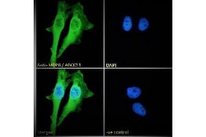 (ABIN302164) Immunofluorescence analysis of paraformaldehyde fixed HeLa cells, permeabilized with 0. (ABCC11 anticorps  (Internal Region))