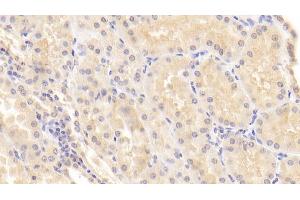 Detection of MMP7 in Human Kidney Tissue using Monoclonal Antibody to Matrix Metalloproteinase 7 (MMP7)