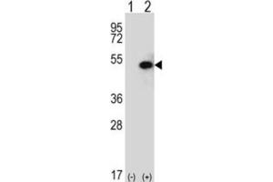 Western Blotting (WB) image for anti-Sphingosine Kinase 1 (SPHK1) antibody (ABIN2995255) (SPHK1 anticorps)