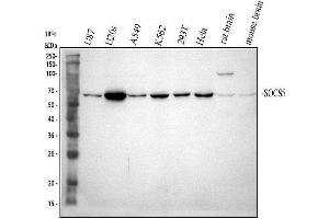 Western blot analysis of SOCS5 using anti-SOCS5 antibody (ABIN7601562). (SOCS5 anticorps  (AA 386-536))
