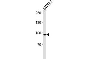 Western Blotting (WB) image for anti-Anoctamin 6 (ANO6) antibody (ABIN3001398) (Anoctamin 6 anticorps)