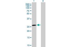 Western Blot analysis of FLJ37201 expression in transfected 293T cell line by FLJ37201 MaxPab polyclonal antibody. (FLJ37201 anticorps  (AA 1-199))