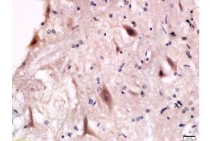 Formalin-fixed and paraffin embedded rat anterior horn of spinal cord labeled with Anti-P2Y12 Polyclonal Antibody, Unconjugated  at 1:200 followed by conjugation to the secondary antibody and DAB staining. (P2RY12 anticorps  (AA 141-240))