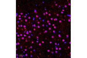 Immunofluorescence of paraffin embedded rat brain using Hes2 (ABIN7074158) at dilution of 1:100 (400x lens)