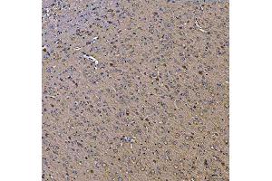 IHC analysis of TOLLIP using anti-TOLLIP antibody (ABIN7599202). (TOLLIP anticorps  (AA 1-274))