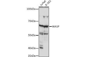 Western blot analysis of extracts of various cell lines, using WASP Rabbit mAb (ABIN7271381) at 1:1000 dilution.