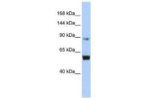 WB Suggested Anti-MCM10  Antibody Titration: 0. (MCM10 anticorps  (Middle Region))