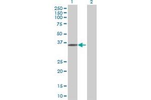 Western Blot analysis of UBR7 expression in transfected 293T cell line ( H00055148-T01 ) by UBR7 MaxPab polyclonal antibody. (UBR7 anticorps  (AA 1-274))