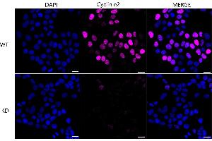 Immunocytochemical staining of HeLa cells using Cyclin e2 antibody (ABIN7798199), 1:1,000), Top panel: wild-type (WT), Bottom panal: Cyclin e2 shRNA knockdown (KD). (Recombinant Cyclin E2 anticorps)