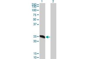 Western Blot analysis of MGC16186 expression in transfected 293T cell line by MGC16186 monoclonal antibody (M02), clone 8G4. (DYDC2 anticorps  (AA 1-177))