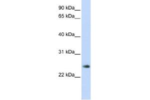 WB Suggested Anti-THYN1 Antibody Titration: 0. (THYN1 anticorps  (Middle Region))