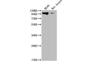 Western Blot Positive WB detected in: HL60 whole cell lysate, Rat brain tissue All lanes: DNM2 antibody at 1:2000 Secondary Goat polyclonal to rabbit IgG at 1/50000 dilution Predicted band size: 99, 98 kDa Observed band size: 99 kDa (Recombinant DNM2 anticorps)