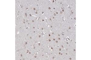 Immunohistochemical staining of human cerebral cortex with NUP155 polyclonal antibody  shows moderate nuclear membrane positivity in neuronal cells at 1:10-1:20 dilution. (NUP155 anticorps)
