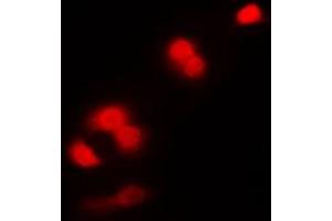 Immunofluorescent analysis of CDC2 staining in K562 cells.