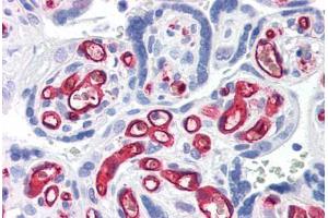 Human Placenta (formalin-fixed, paraffin-embedded) stained with CD34 antibody ABIN337371 at 10 ug/ml followed by biotinylated anti-mouse IgG secondary antibody ABIN481714, alkaline phosphatase-streptavidin and chromogen.