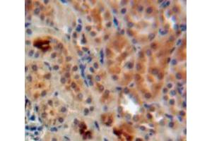 Used in DAB staining on fromalin fixed paraffin-embedded Kidney tissue (ADAP1 anticorps  (AA 45-356))