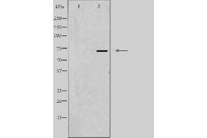 Western blot analysis of extracts from Jurkat cells using FSHR antibody. (FSHR anticorps  (Internal Region))