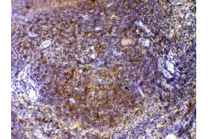 IHC analysis of CTLA4 using anti-CTLA4 antibody .