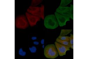 ABIN6258384 and ABIN6274981 staining Hela cells by IF/ICC.