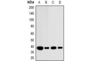 Western blot analysis of IDH3 alpha expression in MCF7 (A), HT29 (B), mouse brain (C), mouse kidney (D) whole cell lysates. (IDH3A anticorps)