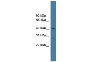 SERPINB7 antibody used at 0. (SERPINB7 anticorps  (N-Term))