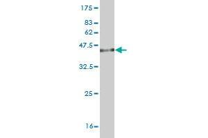 Western Blot detection against Immunogen (37.