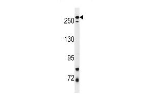 Park8 (LRRK2) Antibody  f western blot analysis in mouse lung tissue lysates (35 μg/lane). (LRRK2 anticorps  (AA 878-909))