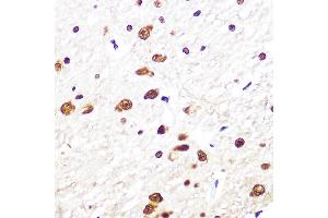 Immunohistochemistry of paraffin-embedded rat brain using SRSF1/SRSF1/SF2/ASF Rabbit mAb (ABIN7270213) at dilution of 1:100 (40x lens). (SRSF1 anticorps)