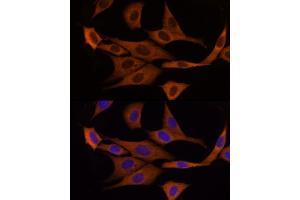 Immunofluorescence analysis of NIH/3T3 cells using GSDMD Rabbit pAb  at dilution of 1:200 (40x lens). (GSDMD anticorps)
