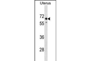 EL1 Antibody (N-term) (ABIN1881545 and ABIN2839006) western blot analysis in human Uterus tissue lysates (35 μg/lane). (MMEL1 anticorps  (N-Term))