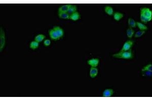Immunofluorescent analysis of HepG2 cells using ABIN7156203 at dilution of 1:100 and Alexa Fluor 488-congugated AffiniPure Goat Anti-Rabbit IgG(H+L) (Indian Hedgehog anticorps  (AA 203-411))