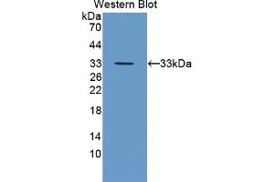 Western blot analysis of the recombinant protein. (FES anticorps  (AA 510-770))
