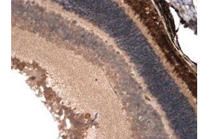 CNGA1/3 Immunohisochemistry Immunohistochemistry of mouse anti-CNGA1/3 antibody.