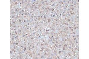 Immunohistochemistry of paraffin-embedded Rat liver using SNW1 Polyclonal Antibody at dilution of 1:100 (40x lens).