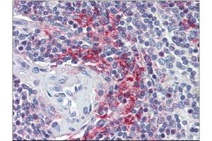 Human Spleen (formalin-fixed, paraffin-embedded) stained with VAV3at 5 µg/ml followed by biotinylated anti-goat IgG secondary antibody, alkaline phosphatase-streptavidin and chromogen. (VAV3 anticorps  (Internal Region))