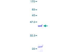 SDS-PAGE (SDS) image for Arachidonate 5-Lipoxygenase-Activating Protein (ALOX5AP) (AA 1-161) protein (GST tag) (ABIN1344923)