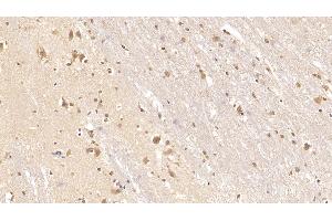 Detection of TNC in Human Cerebrum Tissue using Monoclonal Antibody to Tenascin C (TNC)