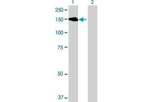 Western Blot analysis of MYLK expression in transfected 293T cell line ( H00004638-T01 ) by MYLK MaxPab polyclonal antibody. (MYLK anticorps  (AA 1-992))