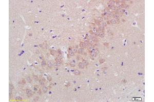 Formalin-fixed and paraffin embedded rat brain labeled with Rabbit Anti Aggrecanase-2/ADAMTS5 Polyclonal Antibody, Unconjugated (ABIN701005) at 1:200 followed by conjugation to the secondary antibody and DAB staining