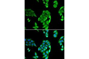 Immunofluorescence analysis of U2OS cells using NOL3 antibody (ABIN6132415, ABIN6144704, ABIN6144706 and ABIN6221927). (NOL3 anticorps  (AA 1-208))