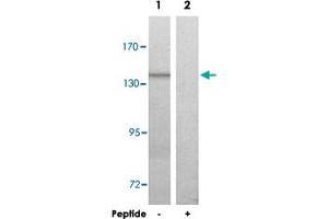 Western blot analysis of extracts from HUVEC cells, using COL20A1 polyclonal antibody . (COL20A1 anticorps  (C-Term))