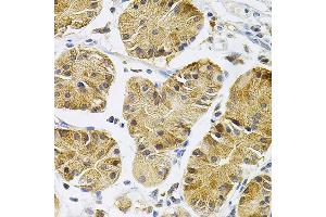 Immunohistochemistry of paraffin-embedded Human stomach using TrkA antibody (ABIN7268895) at dilution of 1:100 (40x lens). (TRKA anticorps  (C-Term))