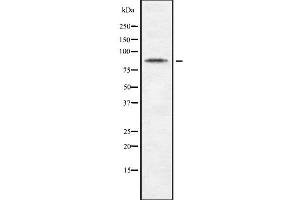 Western blot analysis of CDH10 using Jurkat whole cell lysates