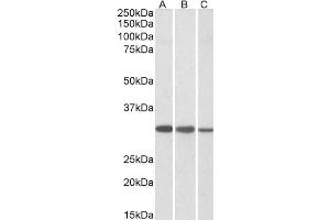 Western Blotting (WB) image for anti-Capping Protein (Actin Filament) Muscle Z-Line, beta (CAPZB) antibody (ABIN5907201) (CAPZB anticorps)