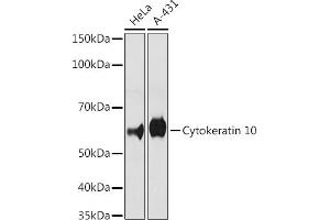 Western blot analysis of extracts of various cell lines, using Cytokeratin 10 antibody (ABIN1679404, ABIN3019133, ABIN3019134 and ABIN7101721) at 1:500 dilution. (Keratin 10 anticorps)