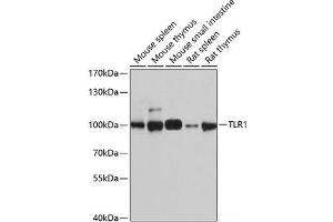 Western blot analysis of extracts of various cell lines using TLR1 Polyclonal Antibody at dilution of 1:1000. (TLR1 anticorps)